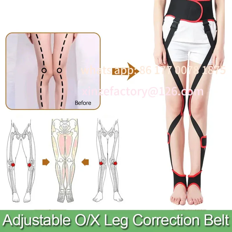 Customizable Adjustable O/X-Type Leg Corrector Legs Correction Available All Day / Day & Night Corretor Leg Bandage Braces
