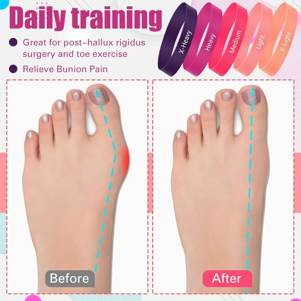 5pcs Bunion Correction Toe Bands Foot Care Hallux Valgus Alignment Toe Straightener Elastic Foot Stretcher Yoga Exercise