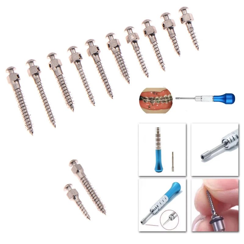 

Dental Implants Anchor Screw Dental Lab Micro Implants Anchor Screw Titanium Self Drilling Screwdriver Different Type Dentist