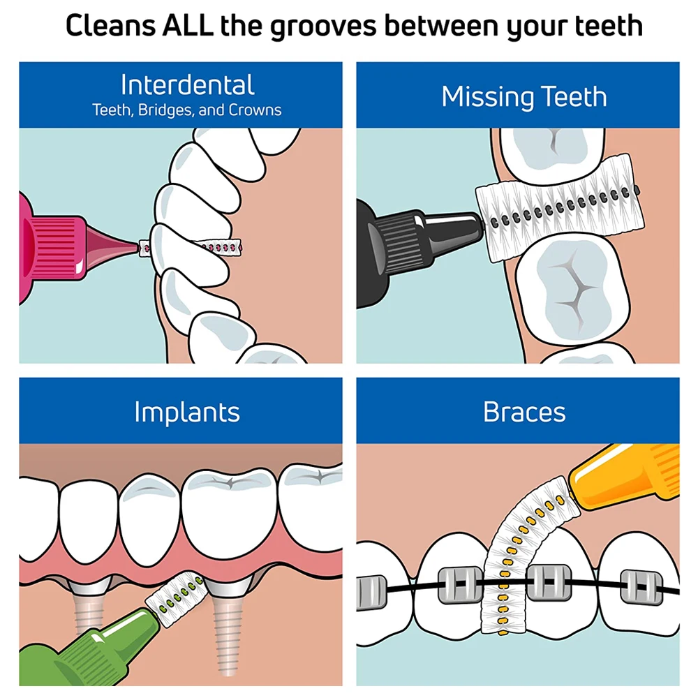Tepe szczoteczki międzyzębowe żółty oryginalny 0.7mm rozmiar 4 07 Mm paczka szwecja Dental Picks dla czyszczenie zębów aparaty ortodontyczne
