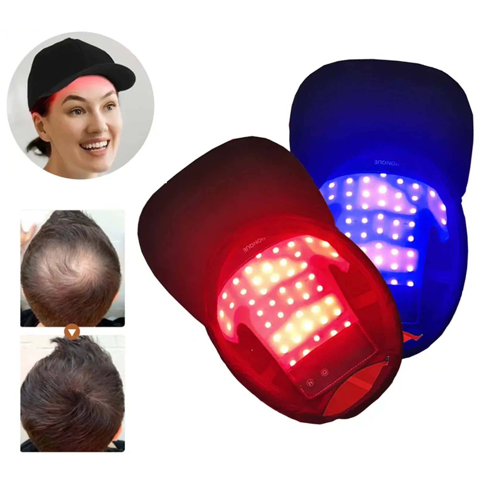 

NEW Hair Growth Cap Red Light Therapy LED Light Haircare Therapy 660nm 850nm Activate Hair follicles Led Lights Scalp soothing