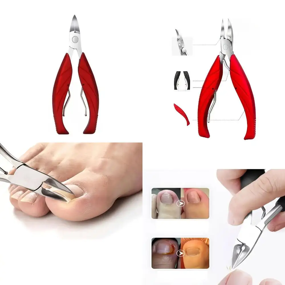 Professional Stainless Steel Nail Clippers for Improved Paronychia Care