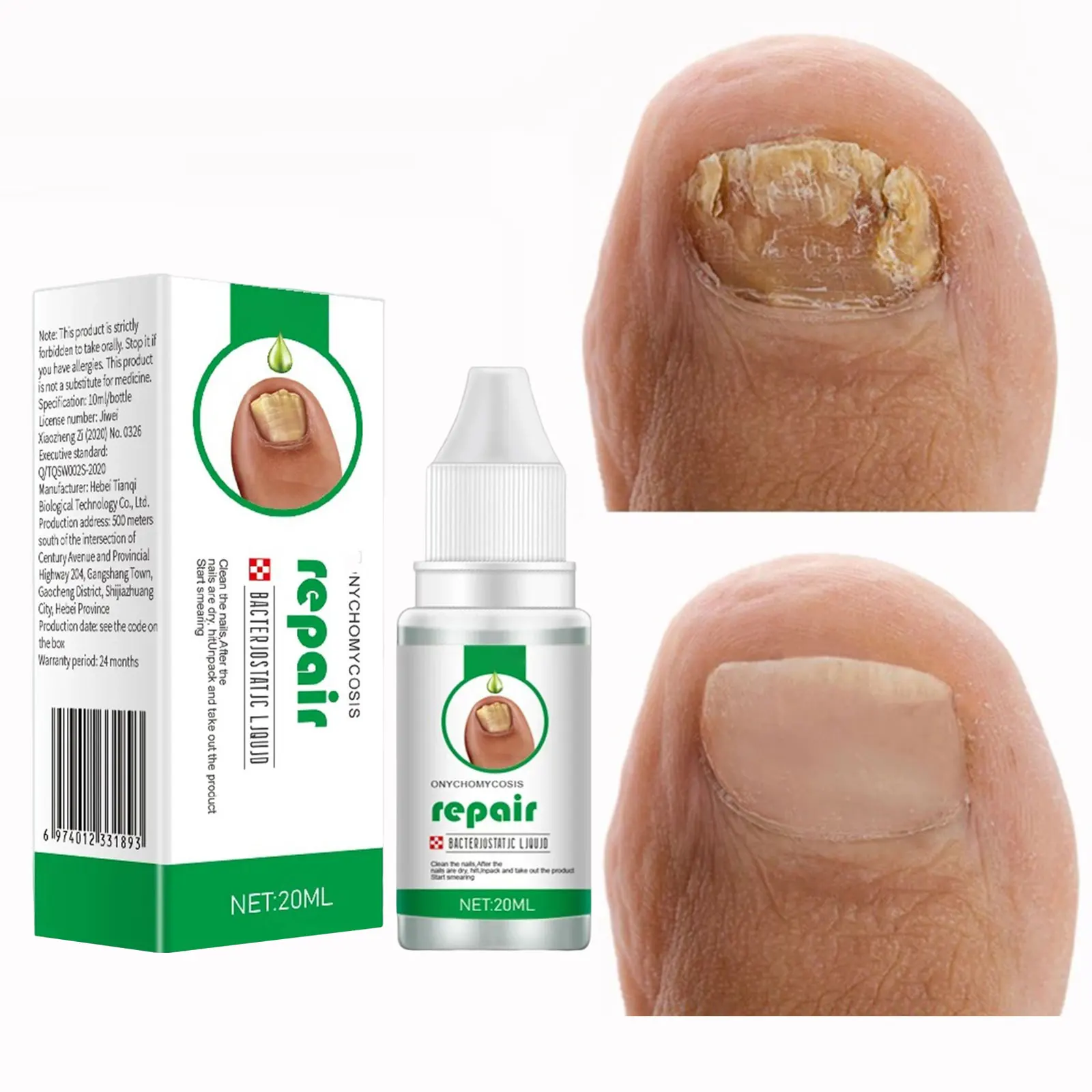 20ml nails repair Essence liquid Renew Damaged, Broken, Cracked & Discolored Nails for Damaged Discolored Yellow Nails