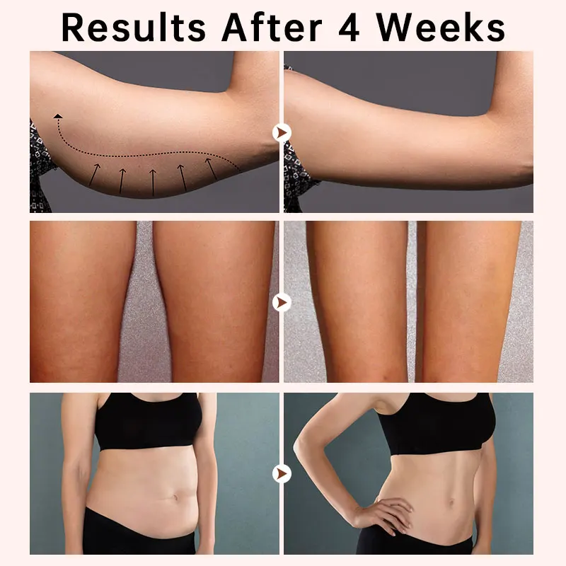 زيت التخسيس المضاد للسيلوليت، فقدان الوزن، حرق الدهون، البطن، التخسيس، تدليك الجسم، العناية بالبشرة