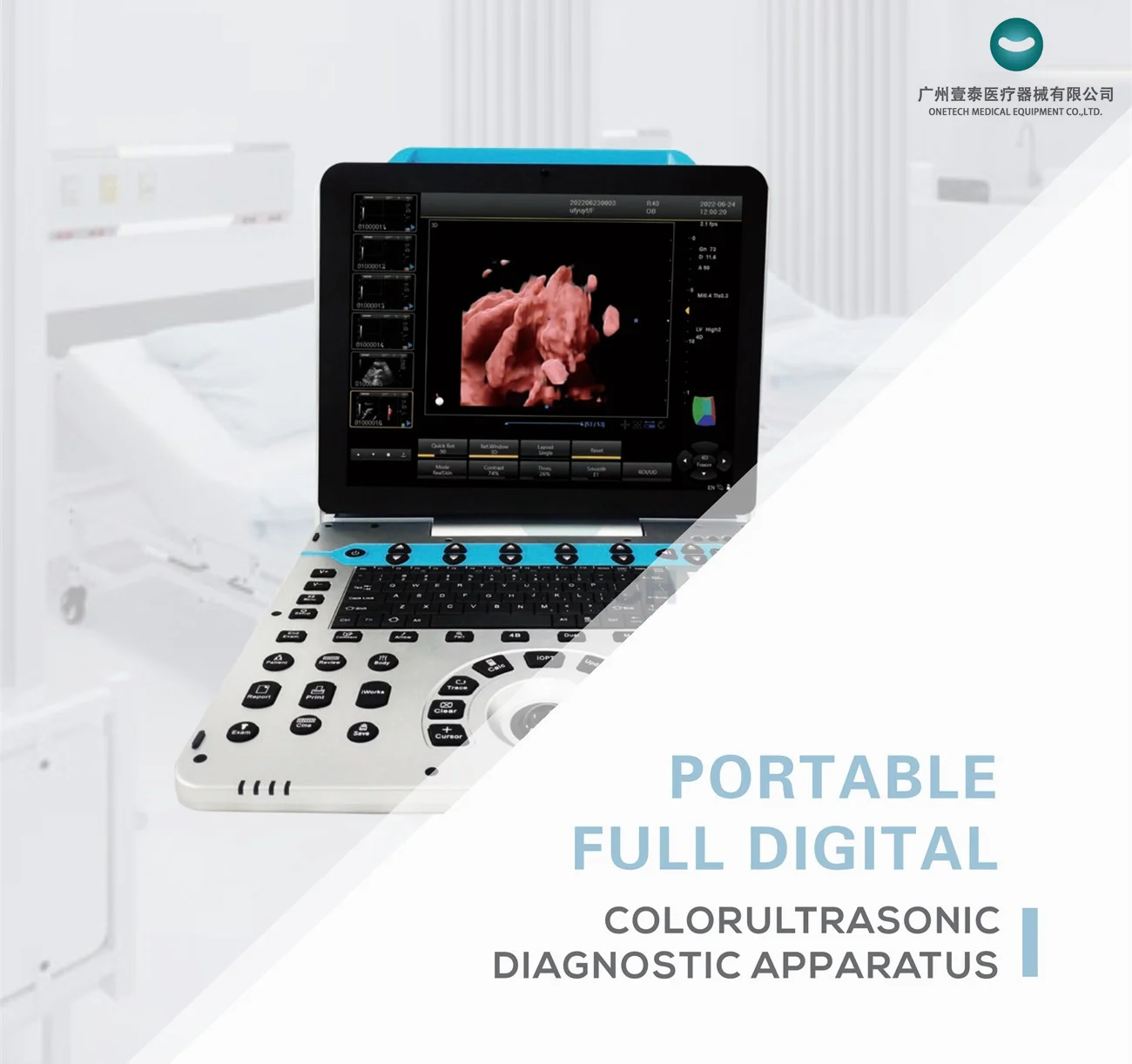 Рисунок 4 - C57 Высококачественная ультразвуковая