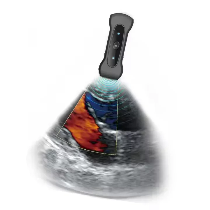 ZY-2A uso veterinário 3 em 1 sondas duplas convexas lineares smartphone usb wifi de ultrasonido portátil picc sonda de ultrassom sem fio rápido