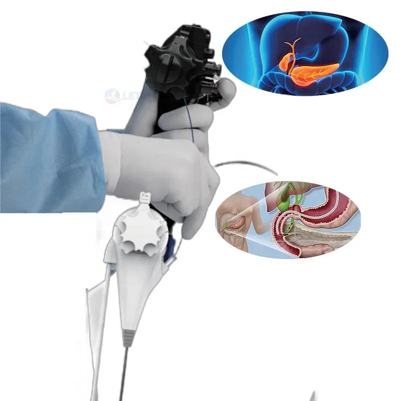 

Medical Flexible Disposable Visual Choledochoscope Digital Video Endoscope Single Use Cholecystoscopy