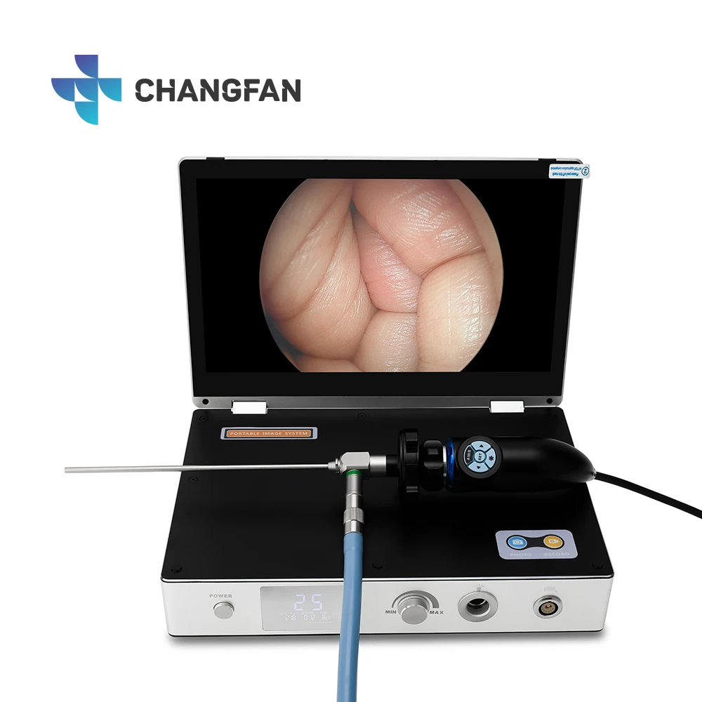 

Медицинская портативная эндоскопическая камера 4 в 1 «все в одном» USB H D M I HD 1080P 11,6-дюймовая портативная камера Moni с источником света