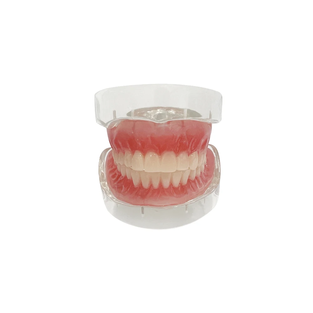 Clear Dental Overdenture Inferior Model - Locator Denture Model Removable Bridge 4 Implants Restoration Teaching Study