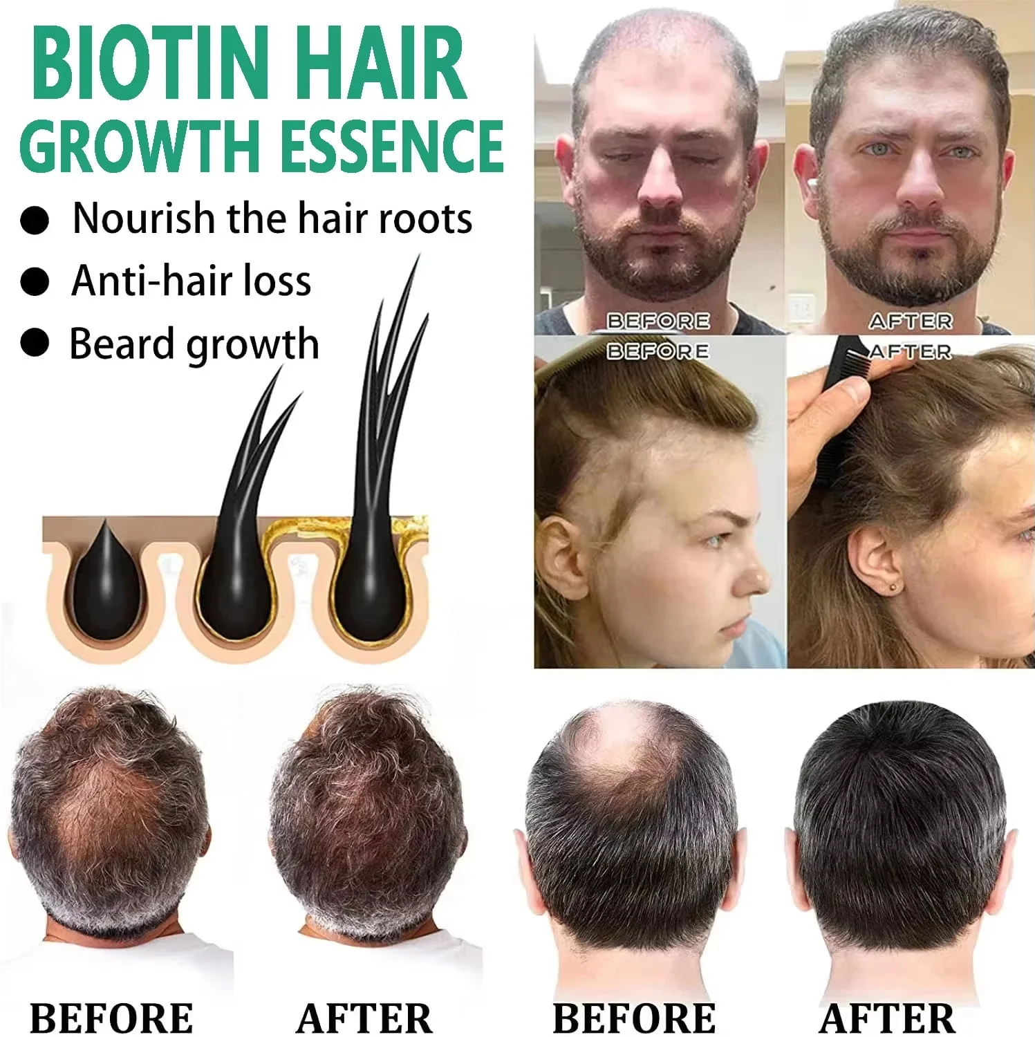 Сыворотка для быстрого роста в – обзор и цена Hair Care Essential Oil Atomizing