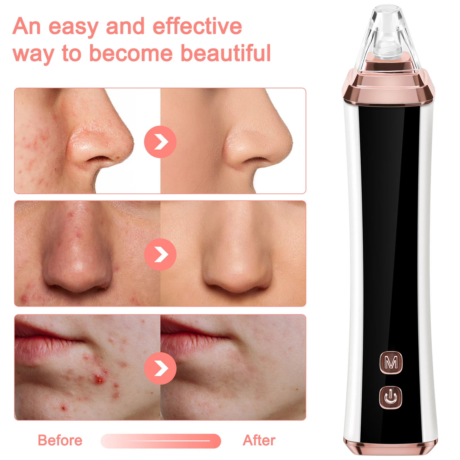 Reducing Acne Blackhead Pore Cleaner Deep Cleaning Blackhead Pore Cleaner for Removing Blackhead Acne and Cleaning Pore