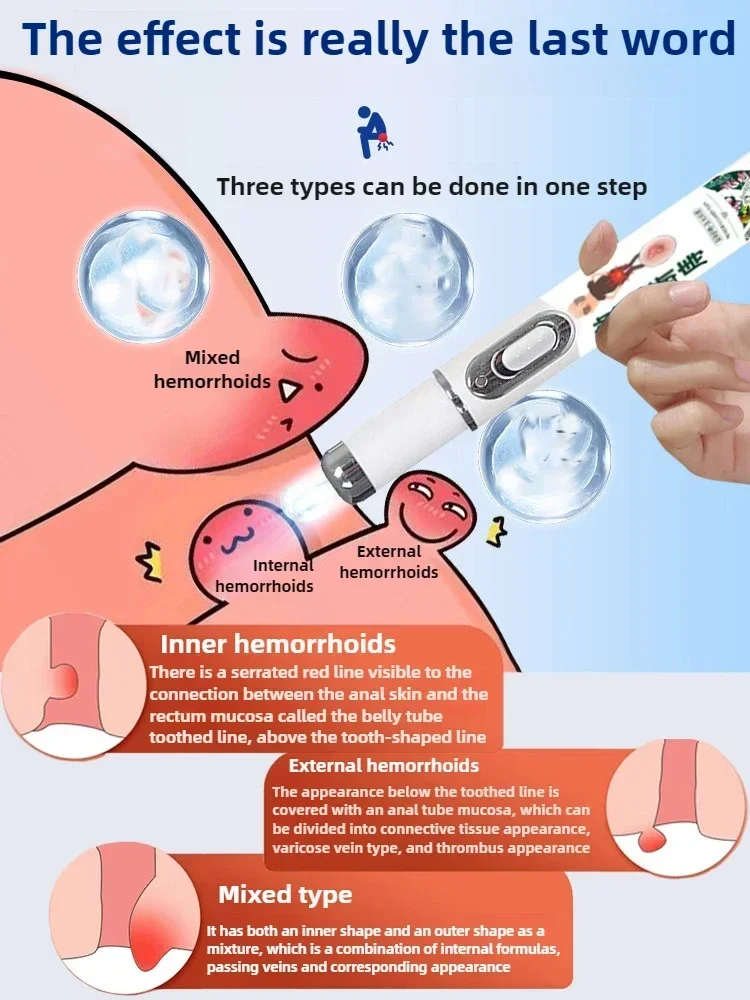 

YP1117 Медицинская лазерная ручка от геморроя. Лечение внешнего внутреннего геморроя. Оболование ануса. Облегчение боли. Лазерная указка. Лечение геморроя.