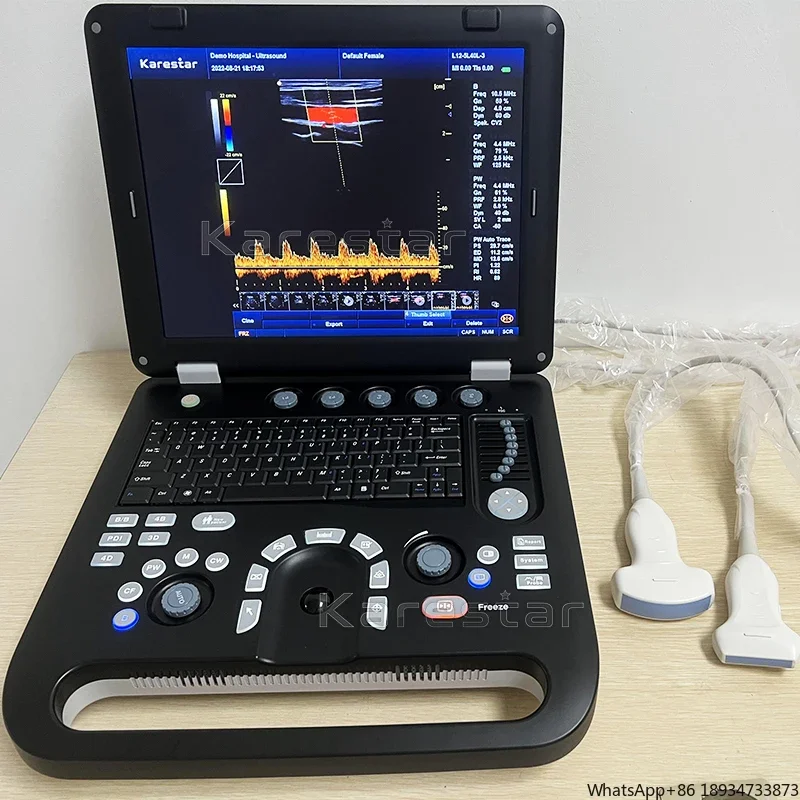 Colour doppler cardiac ultrasound scanner cheapest portable ultrasound machine