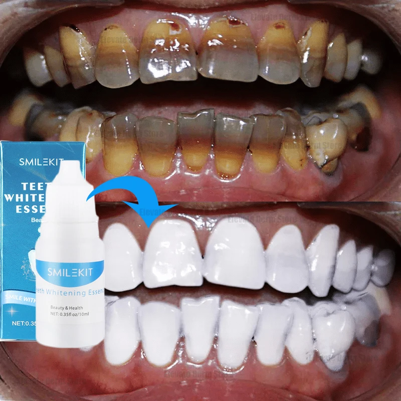 

Teeth Whitening Serum Remove Stains Smoke Coffee Plaque Deep Cleaning Dental Oral Hygiene Fresh Breath Tooth Care Products