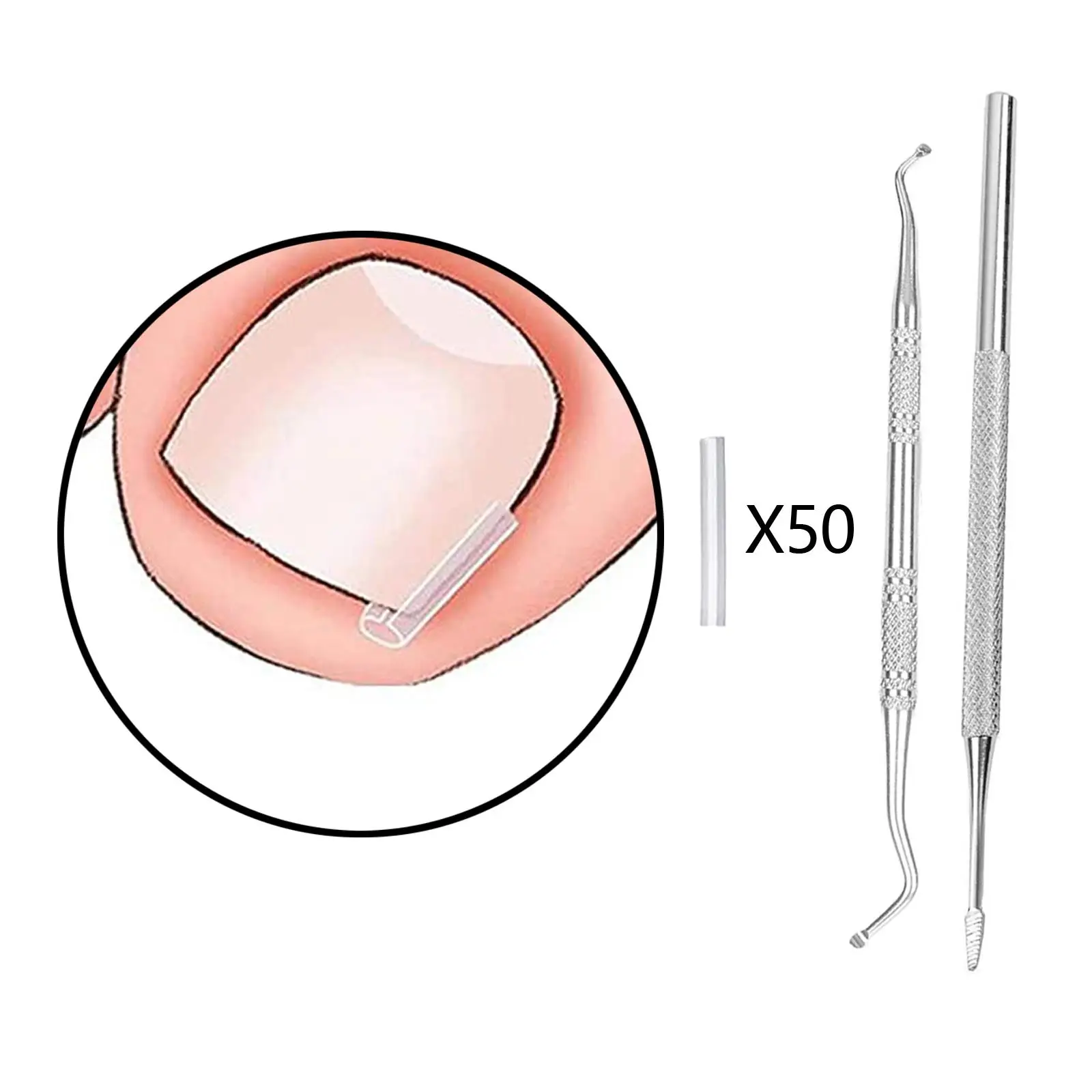 50x คุด Toenail Corrector แถบ Toenail Correction เครื่องมือ Foot Care Men