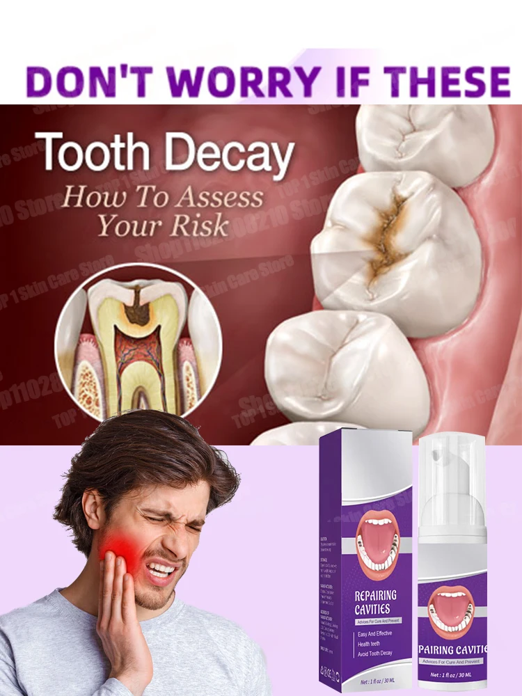 Hot selling Tooth Mousse repair tooth decay removal