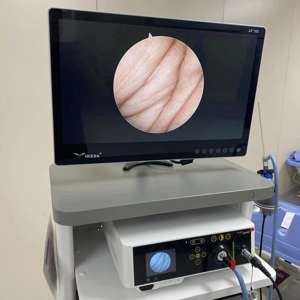 

2025.4 YIKEDA IKEDA Medical Grade Laparoscopic Tower Monitor 19/22/24 Inch