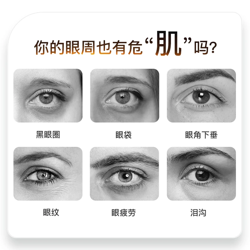 Factory Direct 2026 Top RatedEye beauty instrument hot compress introduction lifting firming eye beauty instrument fading
