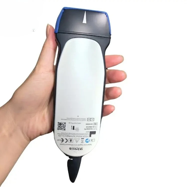 Chison Sonoeye P2 P…