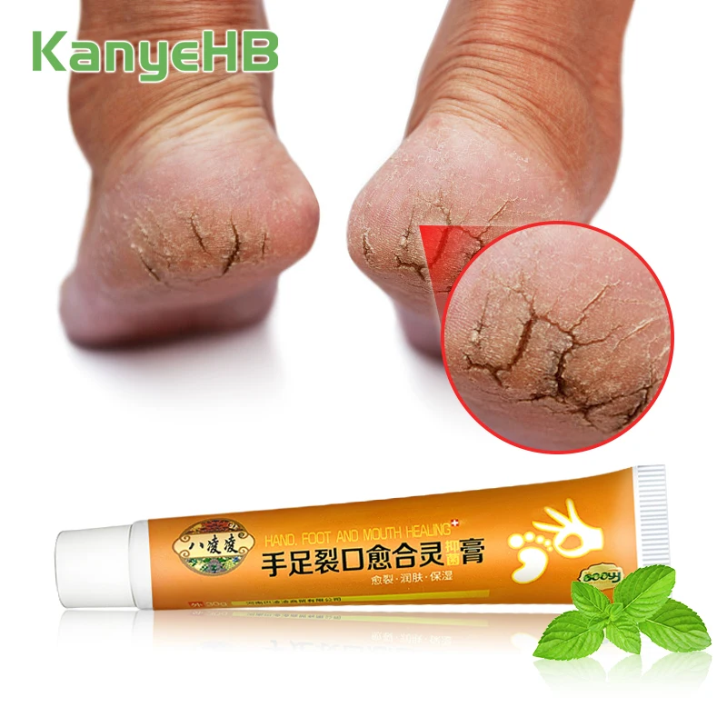 1pcs Foot Chap Treatment Cream Repair Hand Heel Chap Moisturizing Cream Frostbite Reduce Wrinkle Skin Dry Itch Skin Care S012