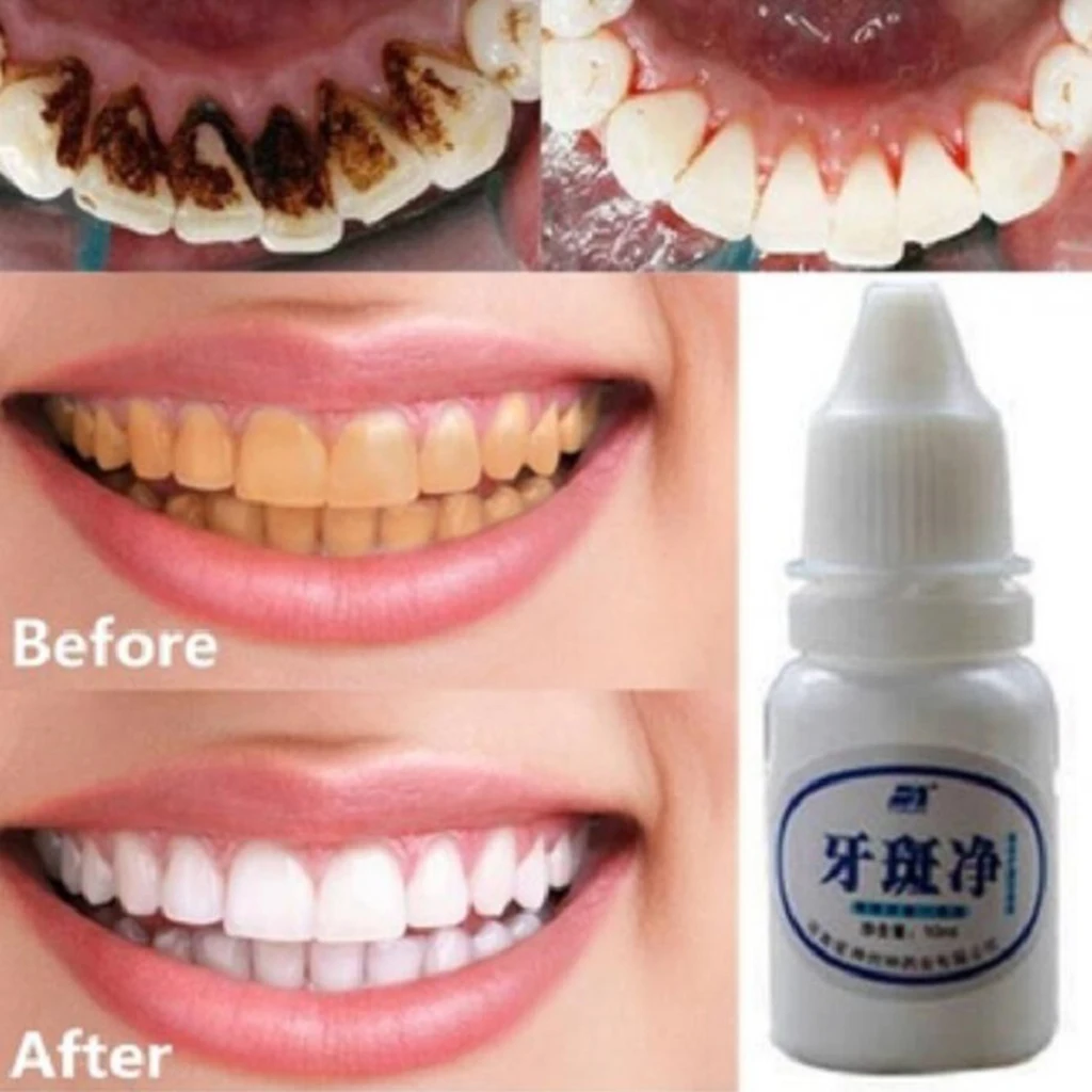 10ML Teeth Oral Hygiene Cleaning Oral Teeth Care Tooth Cleaning Water for Stains From Coffee Tea Removal