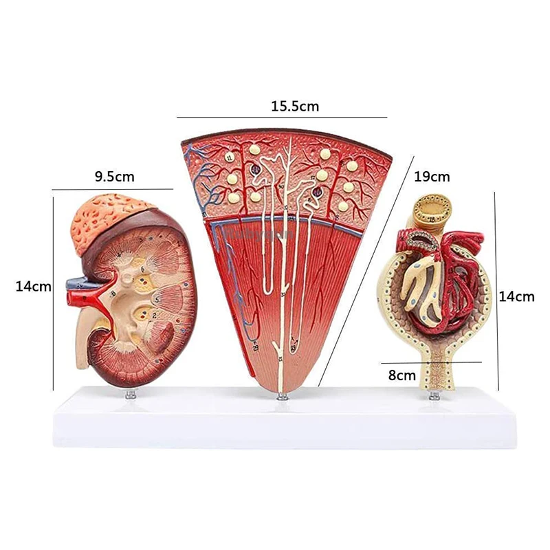 Educational Model Human Organ Anatomical Model Kidney Template with Urinary Glomerular Medical Model for Medical Education