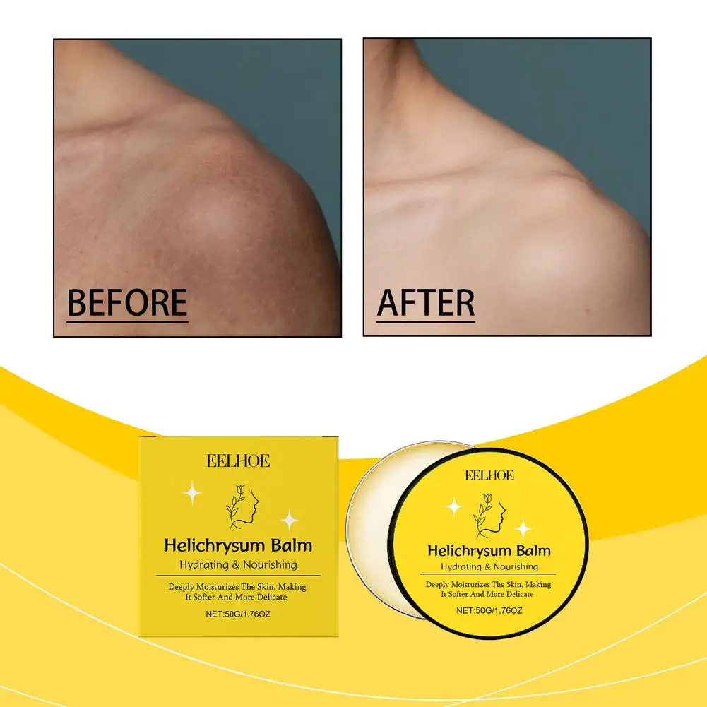 

Frankincense Body Skin Care Belly Leg Firming moisturize Body Cream Health Whitening Beauty Nourishing Lotion Moisturizing W3S3