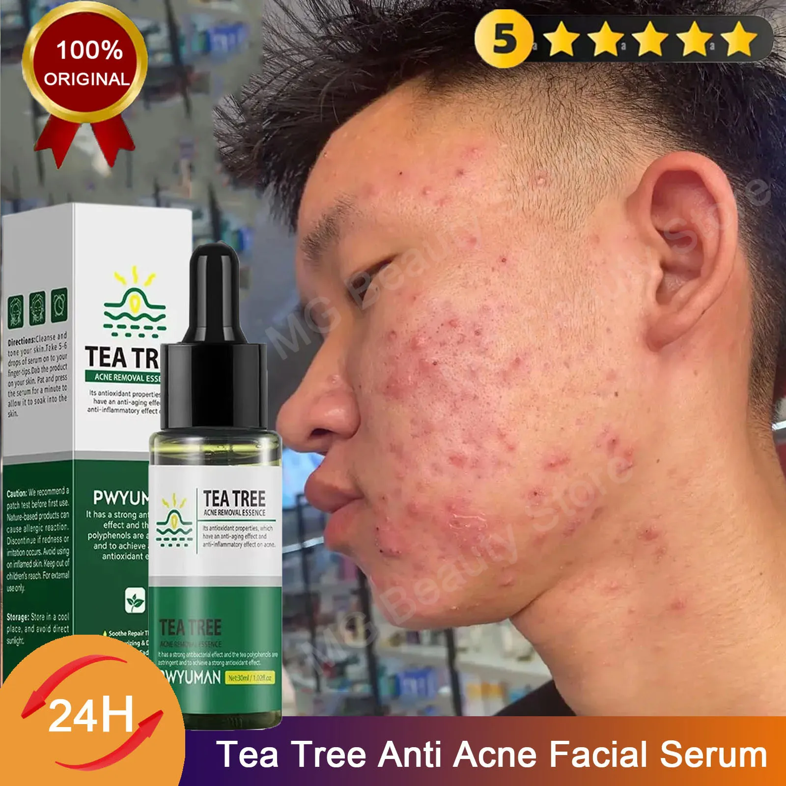 

Tea Tree Acne Removal Face Serum Anti Acne Pimples Remover Black head Pores Shrinking Essential Oil Control Smooth Skin Care