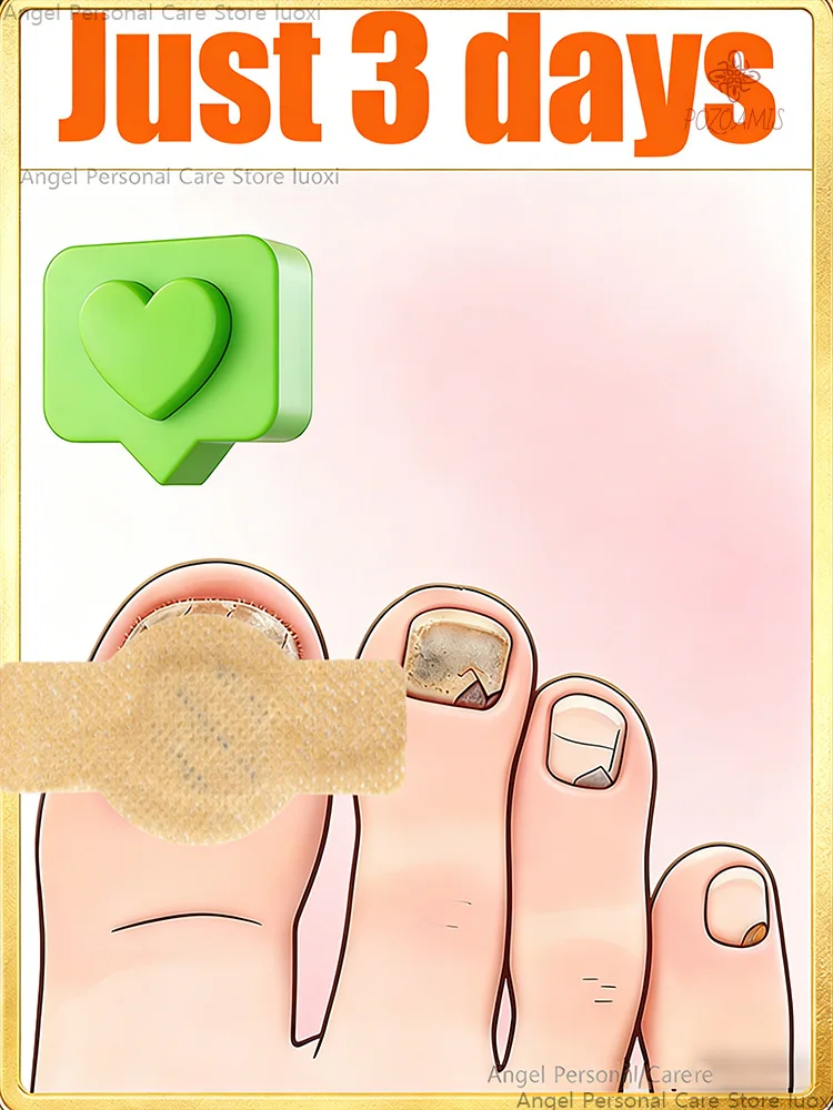 Nail stickers are simple and easy to repair.