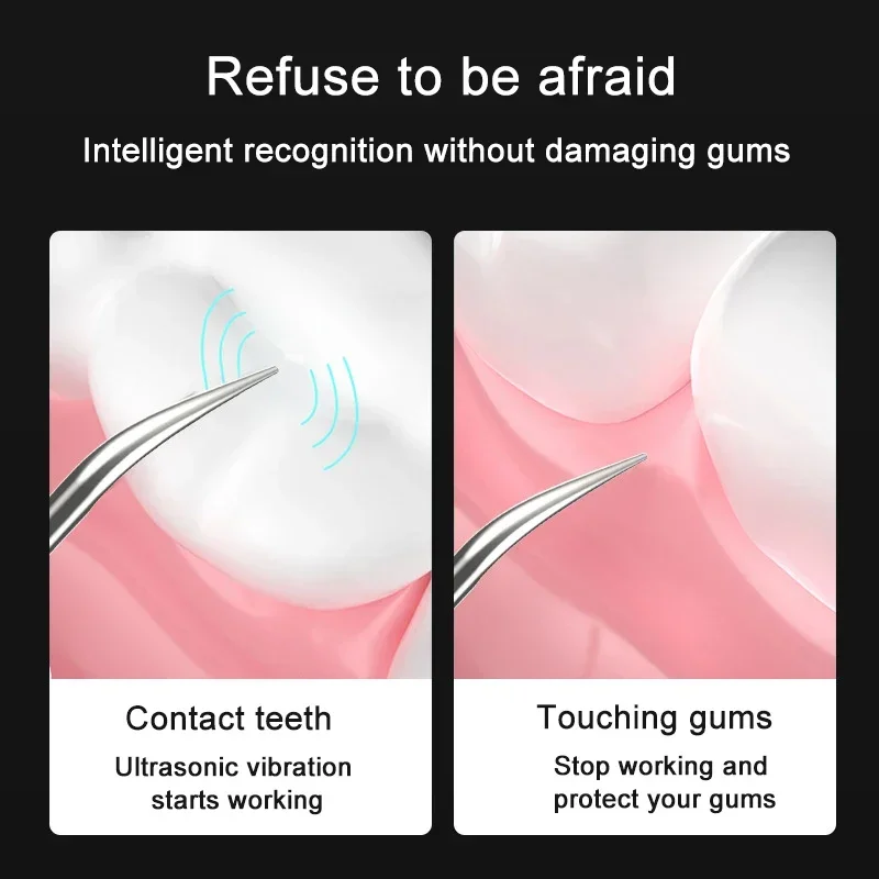 Thumbnail 3 - #42 Compare Ultrasonic Dental Scalers Before You Buy