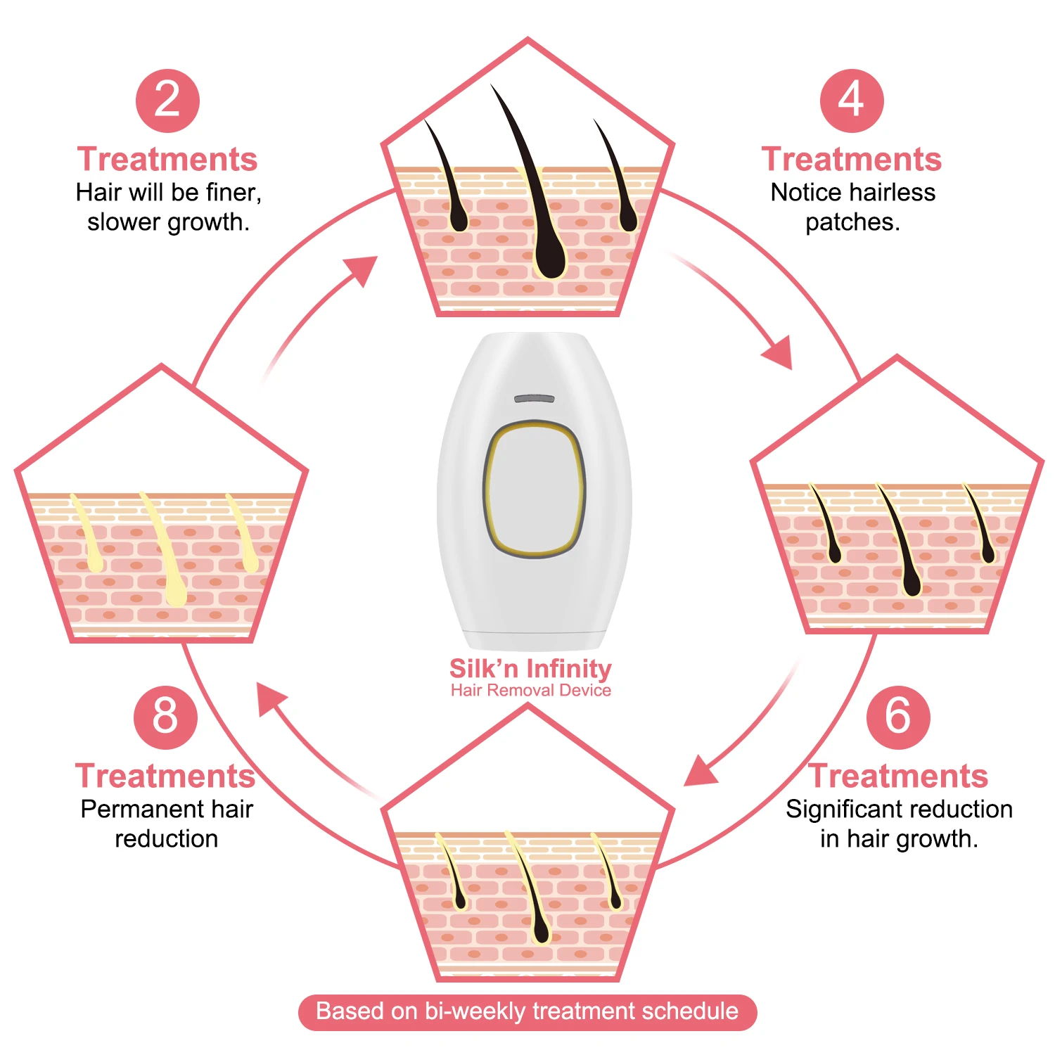 Depilazione Laser per le donne 900000 Flash IPL dispositivo per la rimozione dei capelli fotoepilatore indolore depilatore elettrico