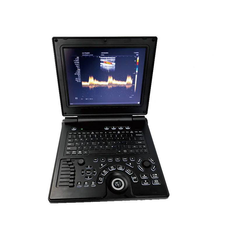 12-Zoll-HD-Display Notebook Farbdoppler-Ultraschalls canner