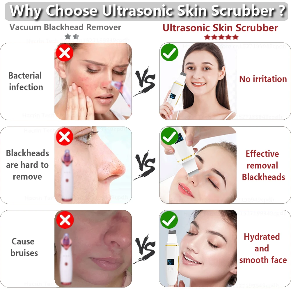 Ultrasonic Skin Scrubber Remover Blackhead Ultrasonic Peeling Facial Scrubber Shovel Deep Cleaning Face Lifting Remove Pore Acne