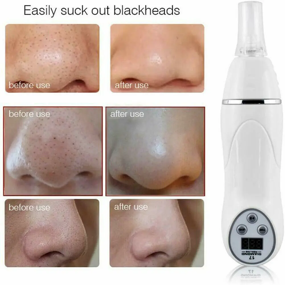 Digital Microdermabrasion Diamond Dermabrasion Pen Vacuum Massage Skin Peeling Acne Treatment Blackhead Removal Cleanser Tool