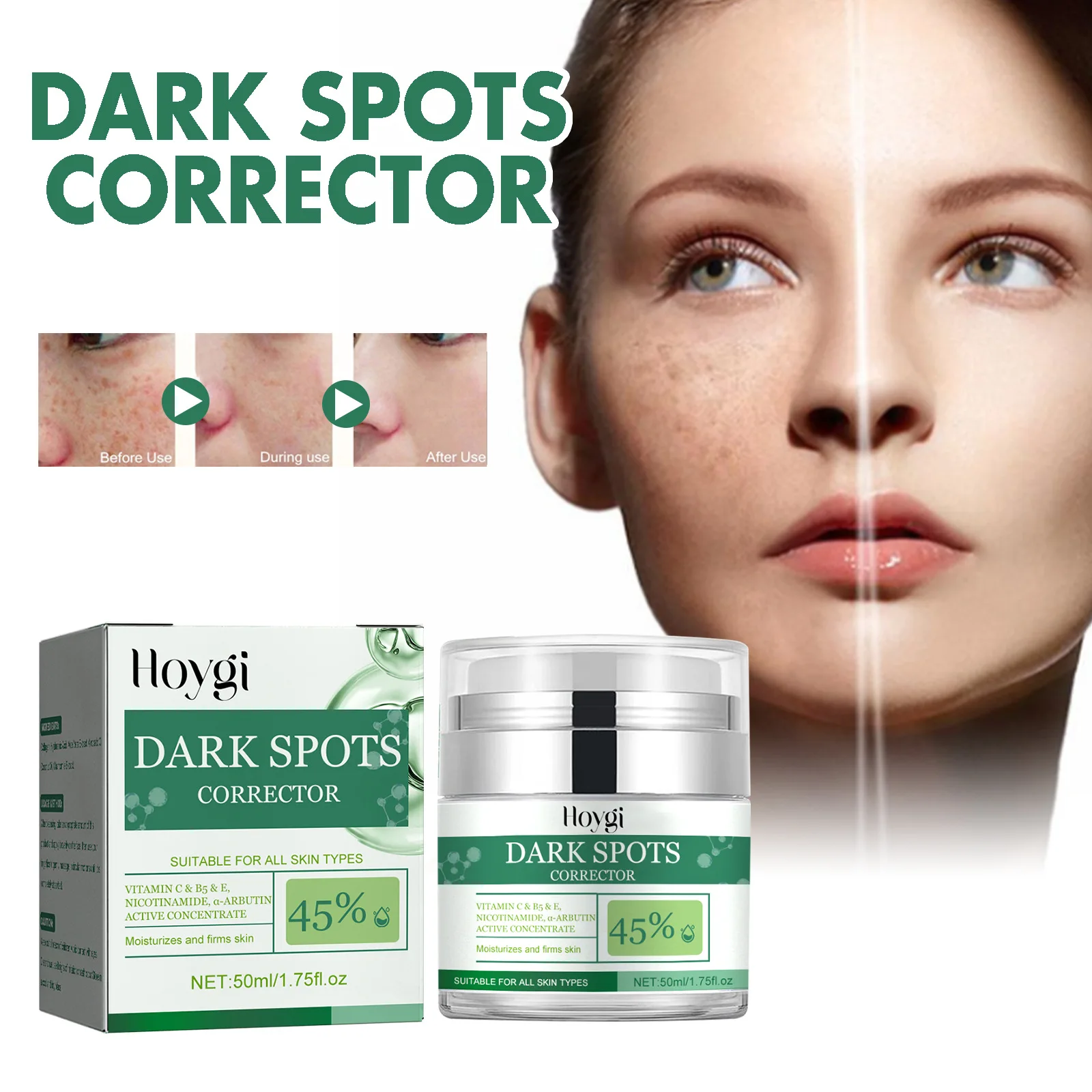 

Hoygi Black Spot Correction Cream Moisturizing and Nourishing Fade Skin Color Spots Melanin Skin Rejuvenation Brightening Cream