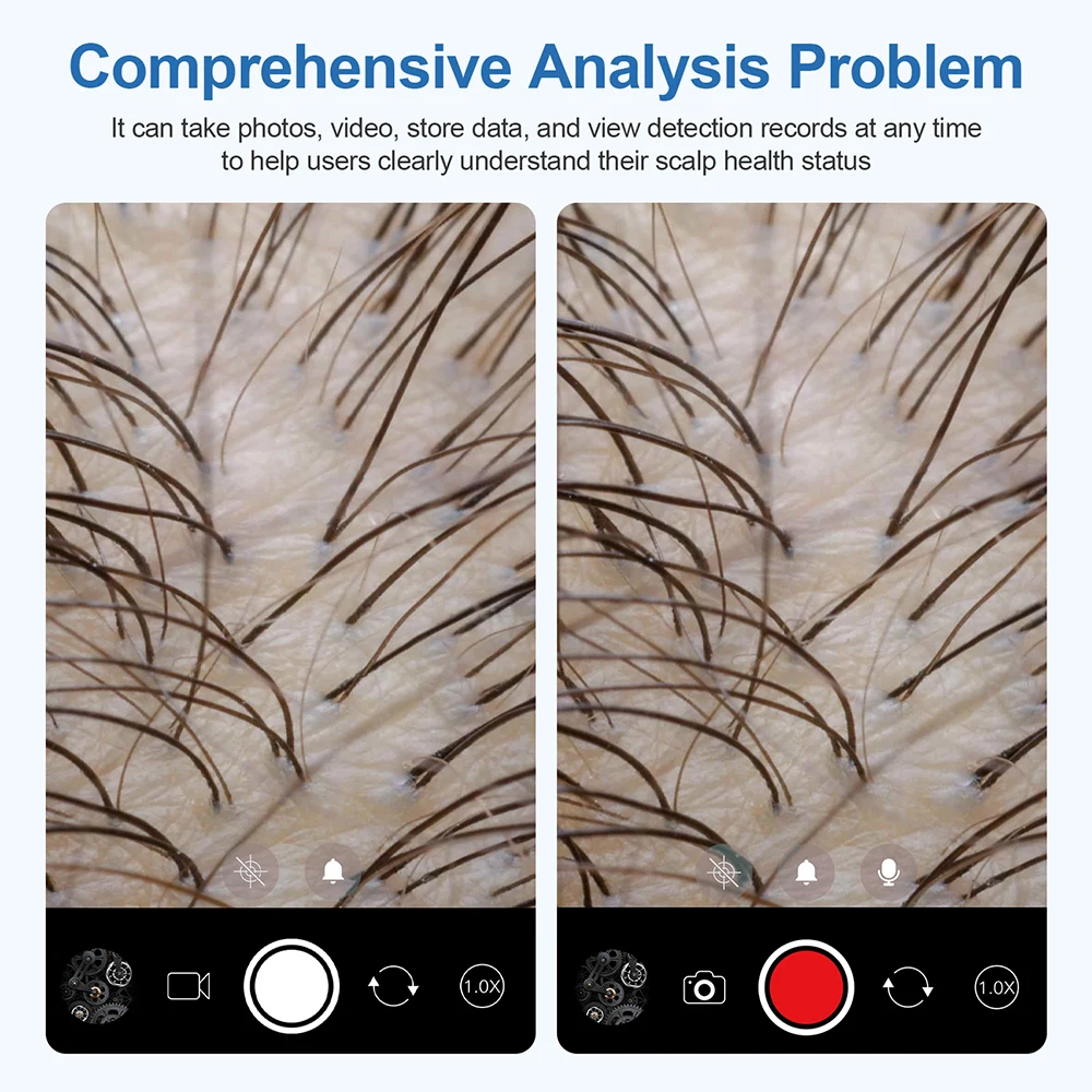 500 ワット HD スキンアナライザー毛包検出器頭皮テスター分析顕微鏡 100 万ピクセル診断スキンケアツール