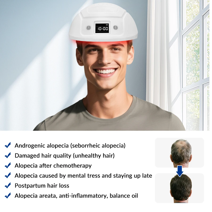 

Advanced Laser Hair Growth System and Red Light Hat for Hair Loss Fall Treatment and Men Thinning Hair Restoration