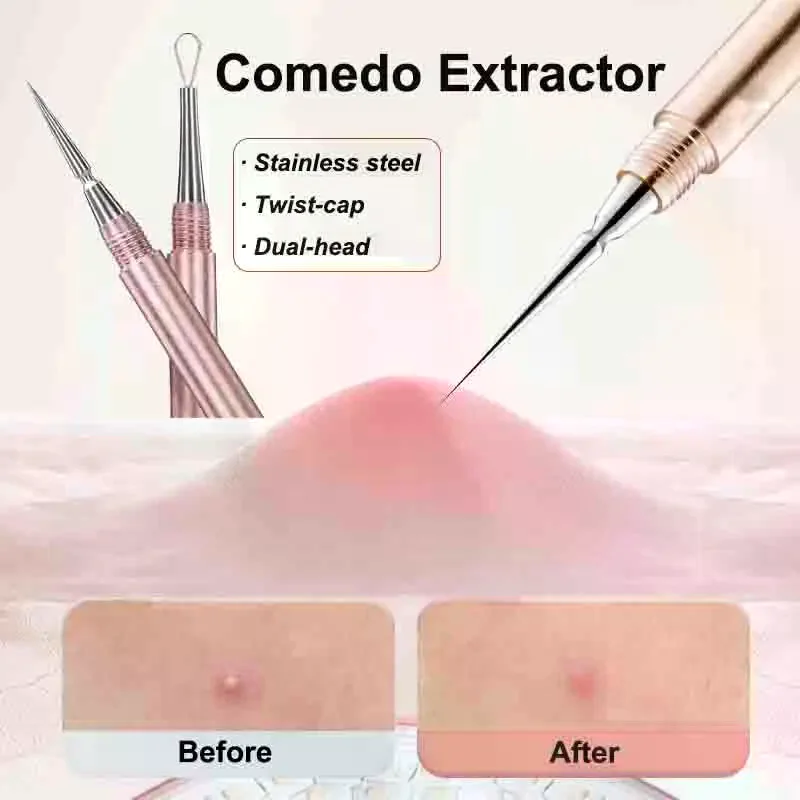 1 Pcs tainless Steel Needles Remove Tools Blackhead Comedone Acne Pimple Blemish Extractor Remover SFace Skin Care Pore Cleaner