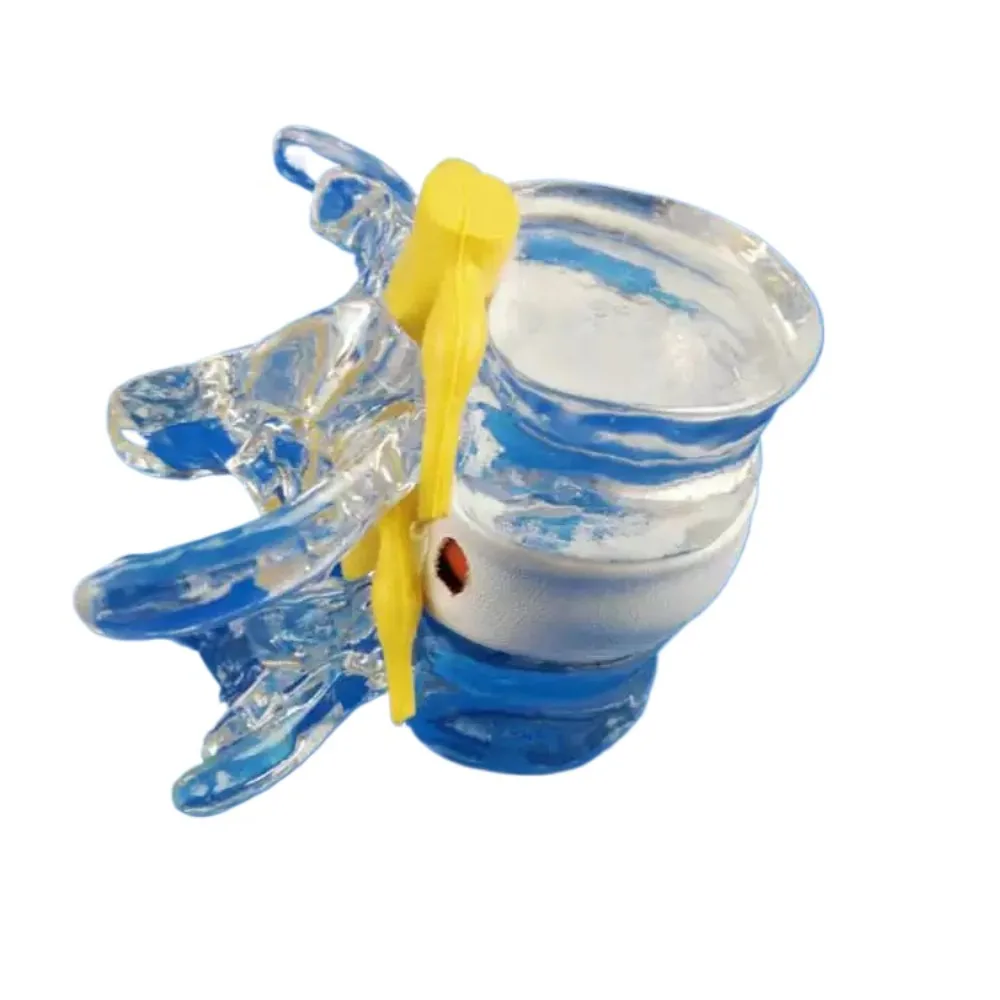 1.5X Human Lumbar Spine Anatomical Model Degenerative Lumbar Disc Herniation Demonstration Teaching Model