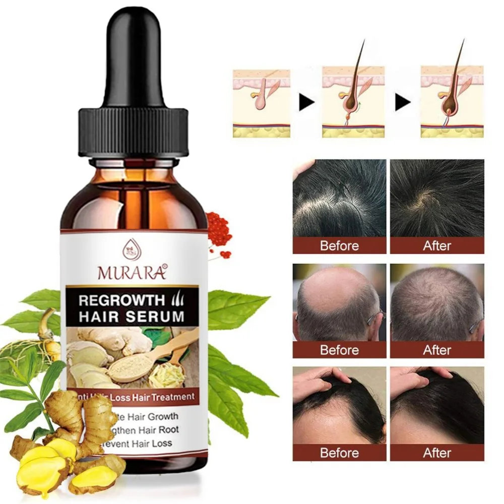 Anti-Hair Loss Essential Oil Dredges Hair Follicles Hair Growth Serum Hair Treatement Oil