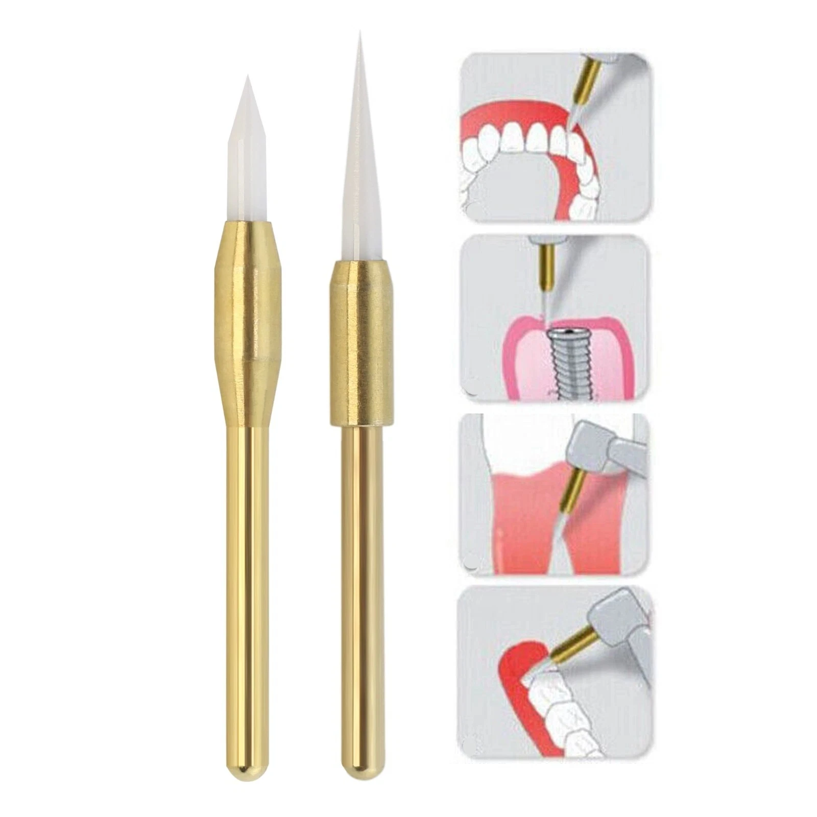 

1pcs Dental Surgical Soft Trimmer Burs Ceramic Soft Tissue Gingiva Trimmer for Gingival Retraction Implant Tool 21mm/23mm