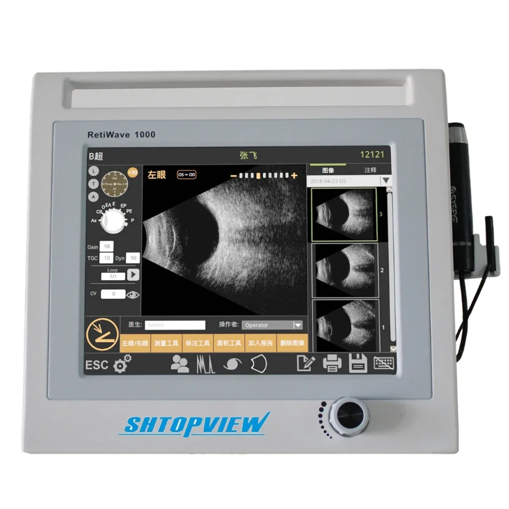 Retiwave-1000 Ophthalmic A B Scan for Ophthalmology digital ultrasonic system stored images could be adjusted voluntarily