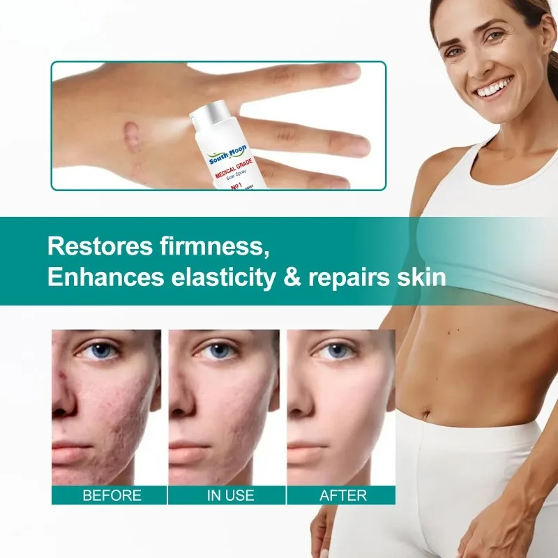 

Scar Care Spray Desalinates Scar Pregnancy Scar Smoothing Skin Care Spray Fade Scars, Reduce Scar Formation