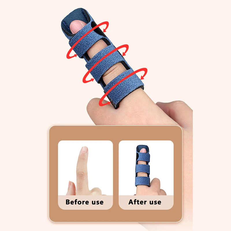 

1pc Trigger Finger Splint, Brace Support With 3 Adjustable Fixing Belt, Finger Straightener For Middle/Ring/Index/Pinky/Thumb,