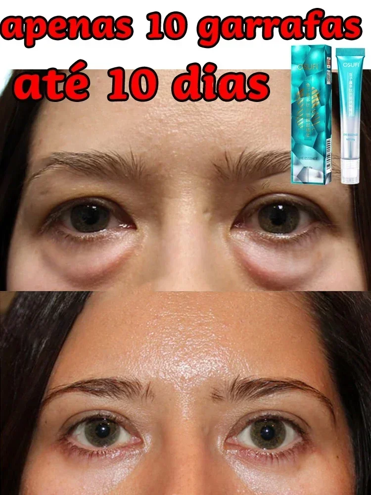 7 Days Magical Anti-Wrinkle Eye Cream Fade Fine Lines Anti Dark Circles Serum Remove Eye Bags Puffiness Anti-Aging Firm Eye Care