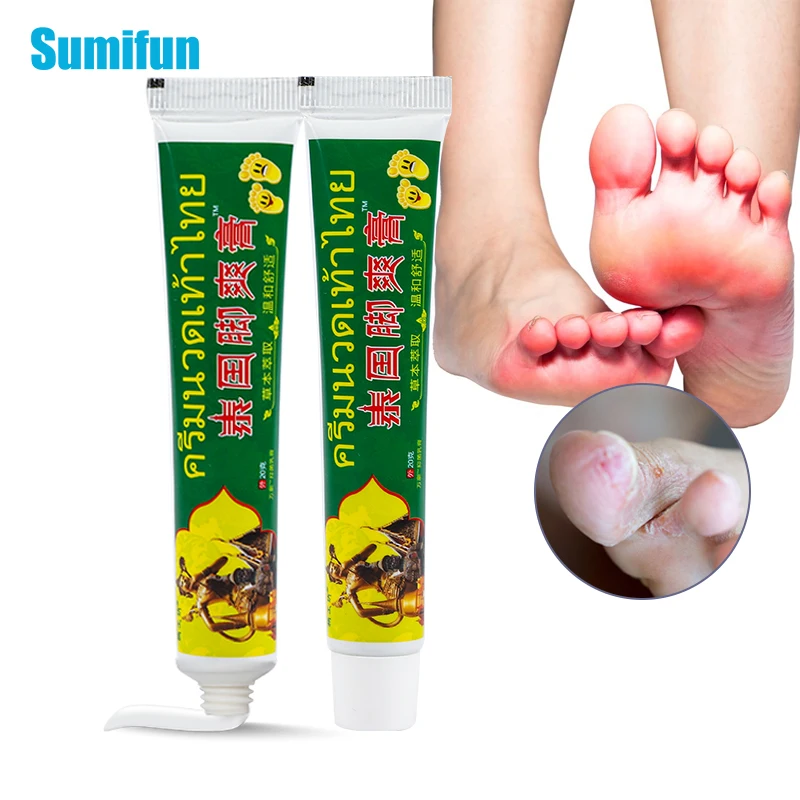 

2pcs Foot Tinea Pedis Treatment Cream Treat Beriberi Ointment Anti-itch Inhibits Fungus Peeling Athlete Foot Medical Plaster 20g