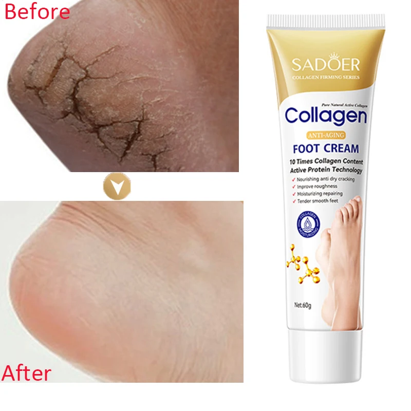

Anti-Drying Foot Cream Crack Resistance Special Care Cream Nourishing Moisturizing Dead Skin Remover Heel Repair Feet Care Cream