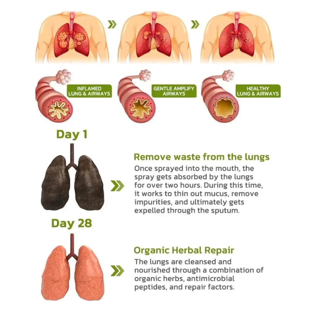 Espray limpiador de hierbas de pulmones para fumadores, Spray de respiración de garganta seca transparente, niebla Nasal, Anti ronquidos, congestión, alivia la solución, 2 piezas