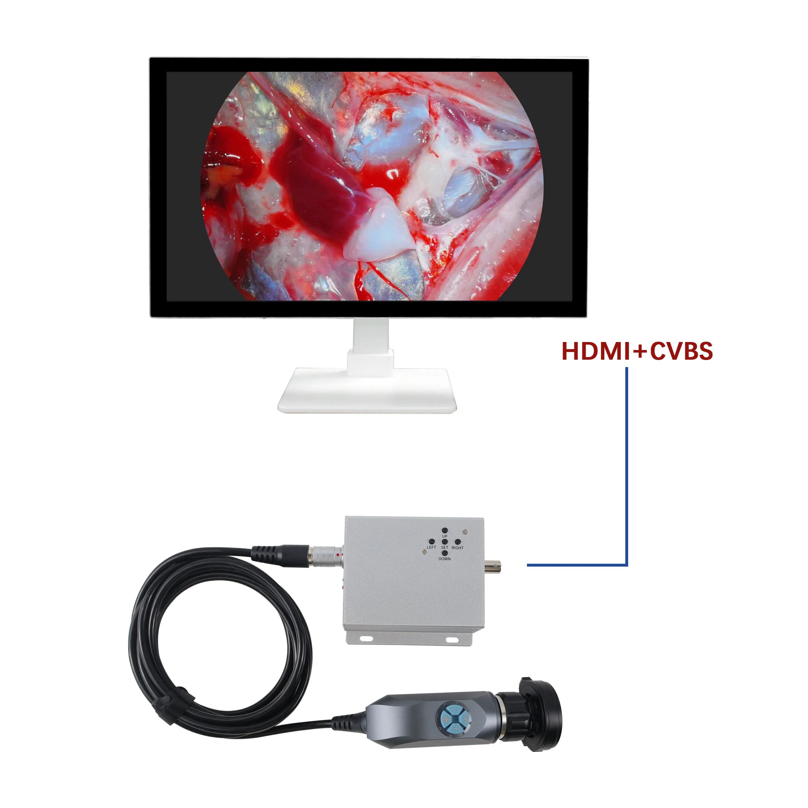 Hospital Clinic Otolaryngology Hd Endoscopic System Mini Video Endoscope