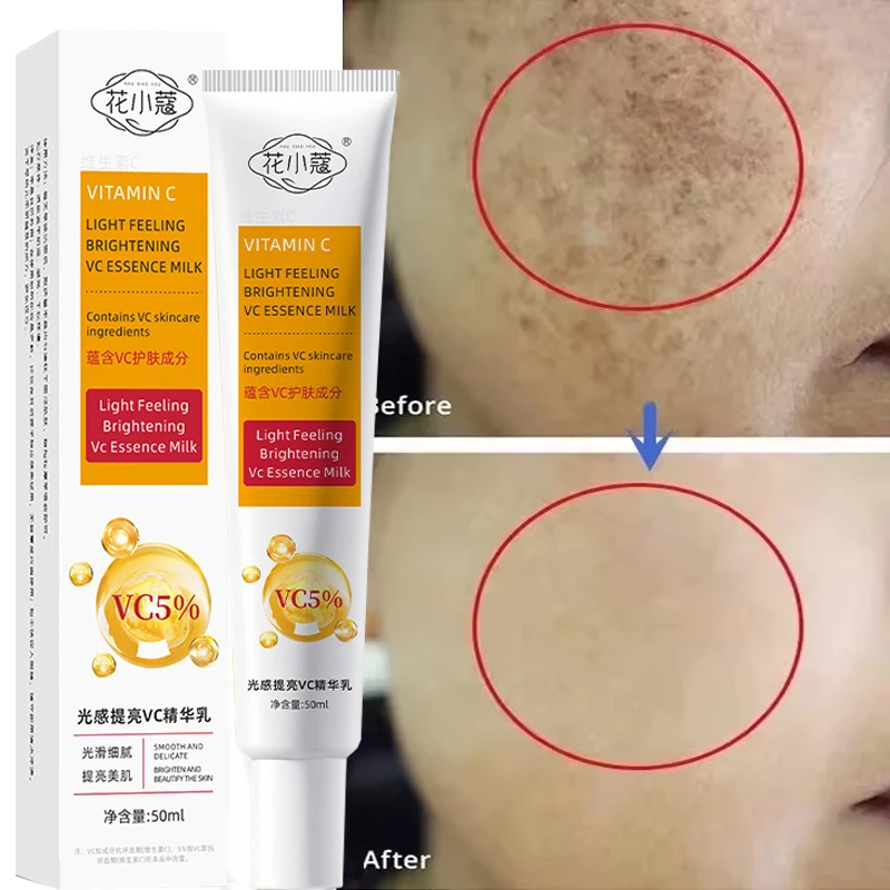 

Vitamin C Freckle Removing Whitening Cream Fade Pigmentation Melasma Dark Spots Corrector Repair Serum Korean Skin Care